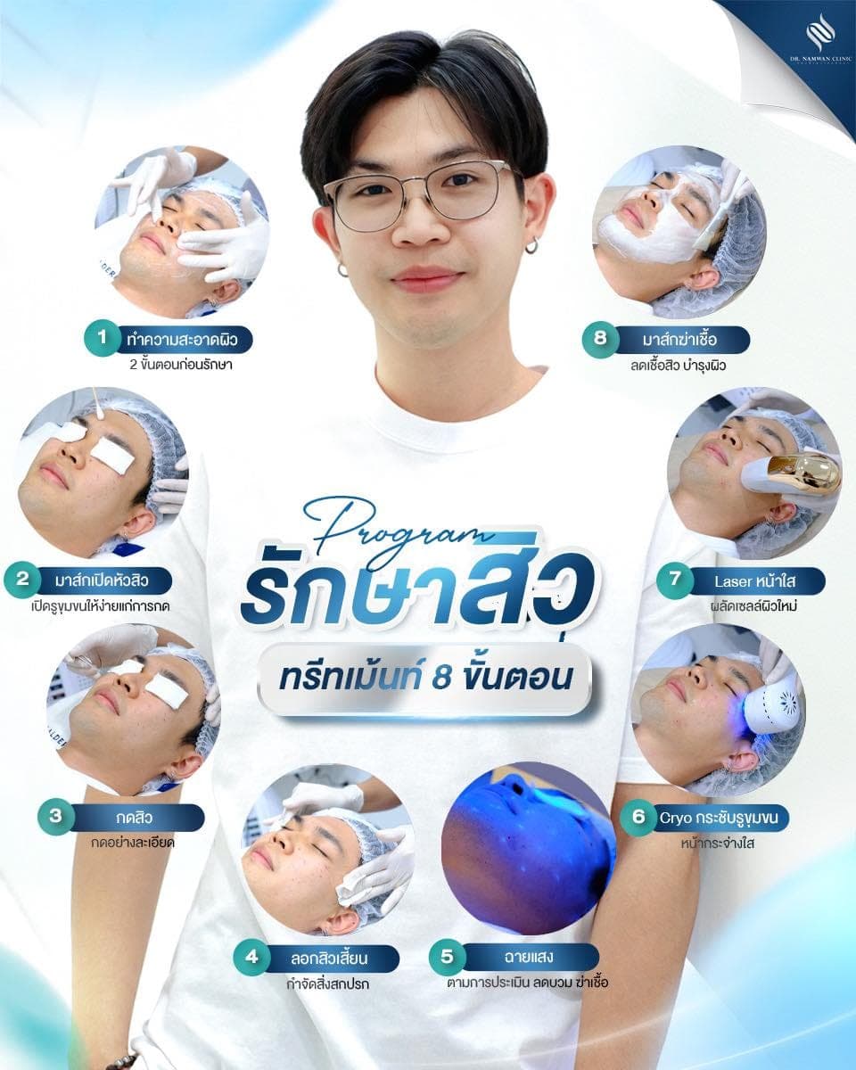 Program Treatment Acne (รักษาสิว)
