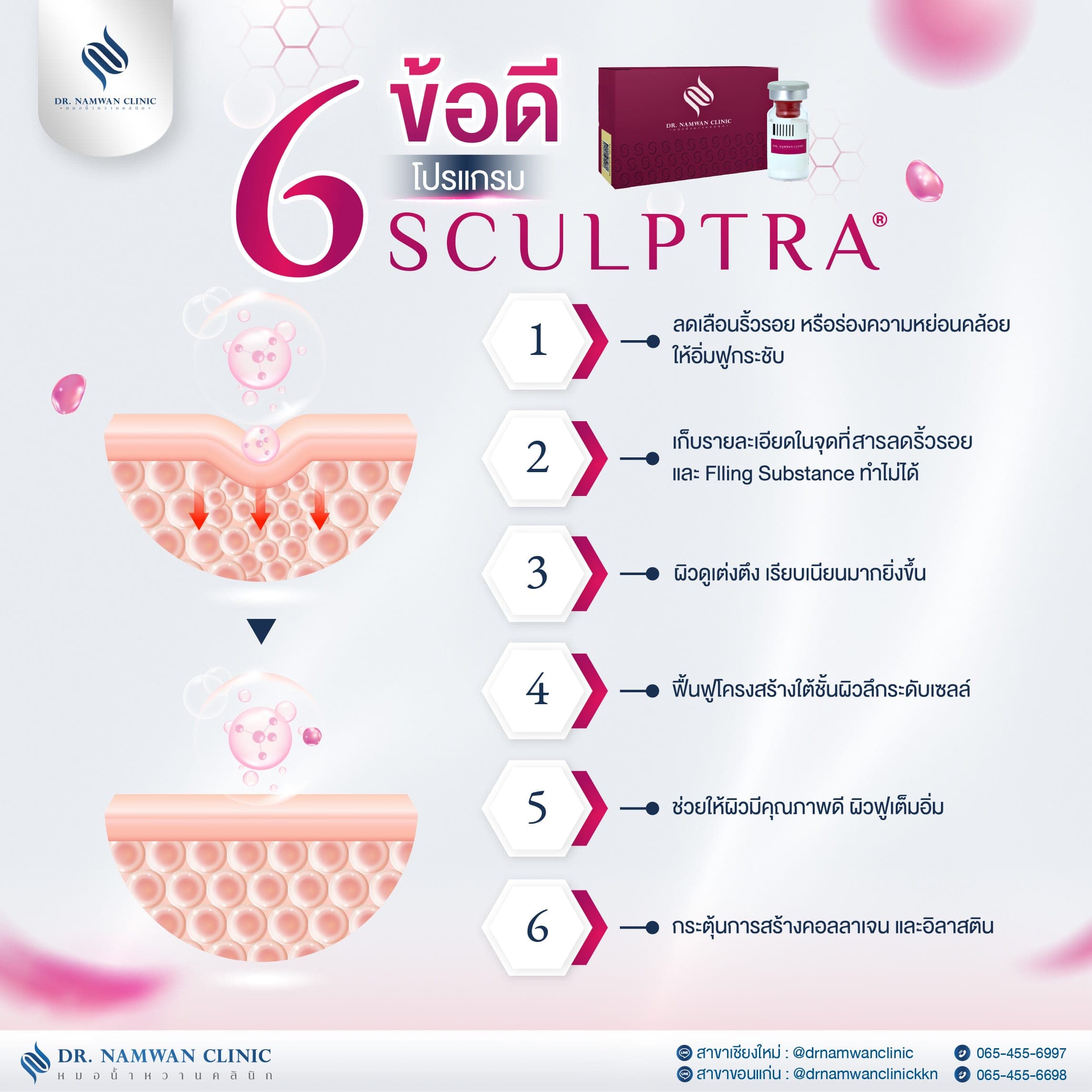 Program Sculptra