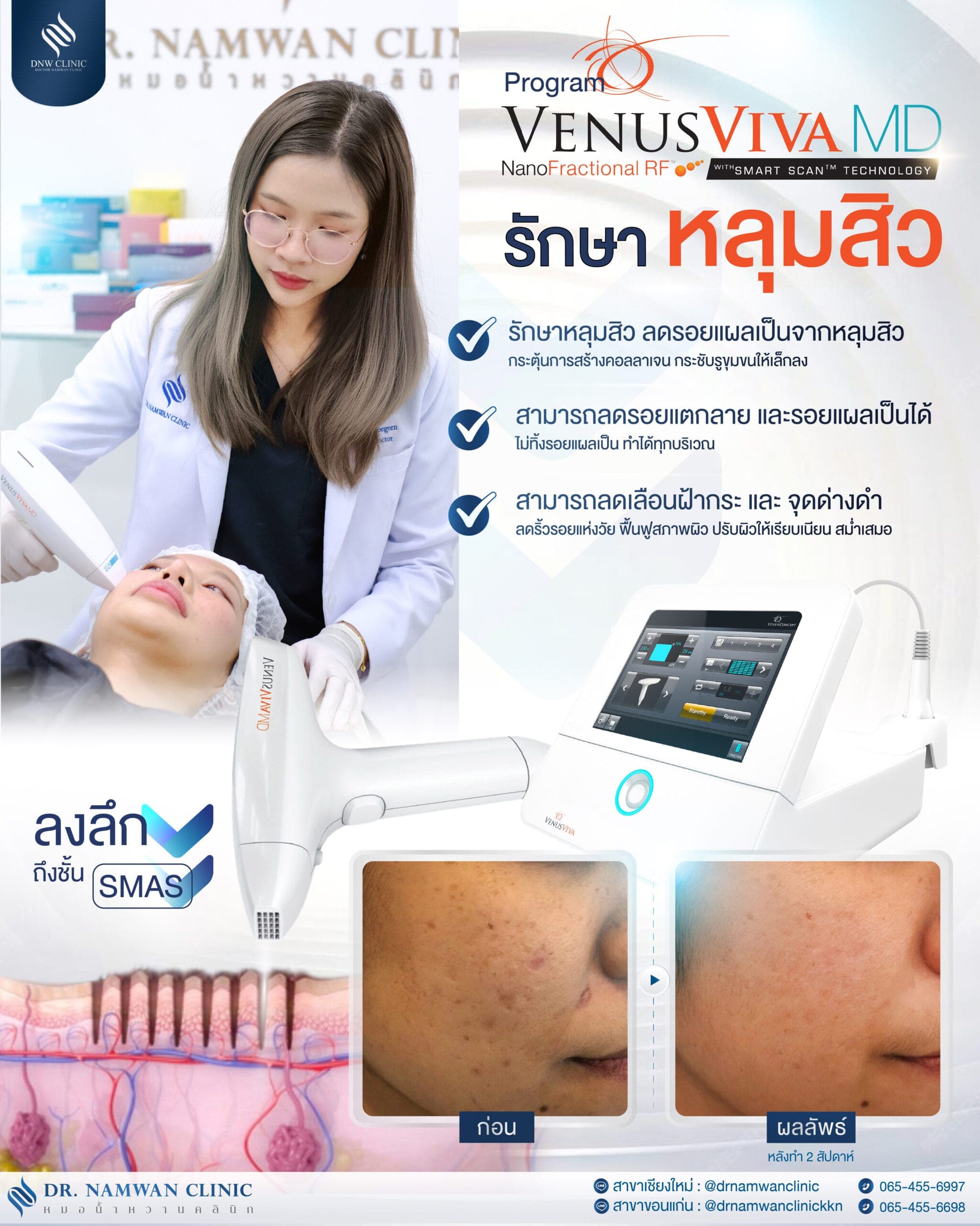 Program Venus Viva MD
